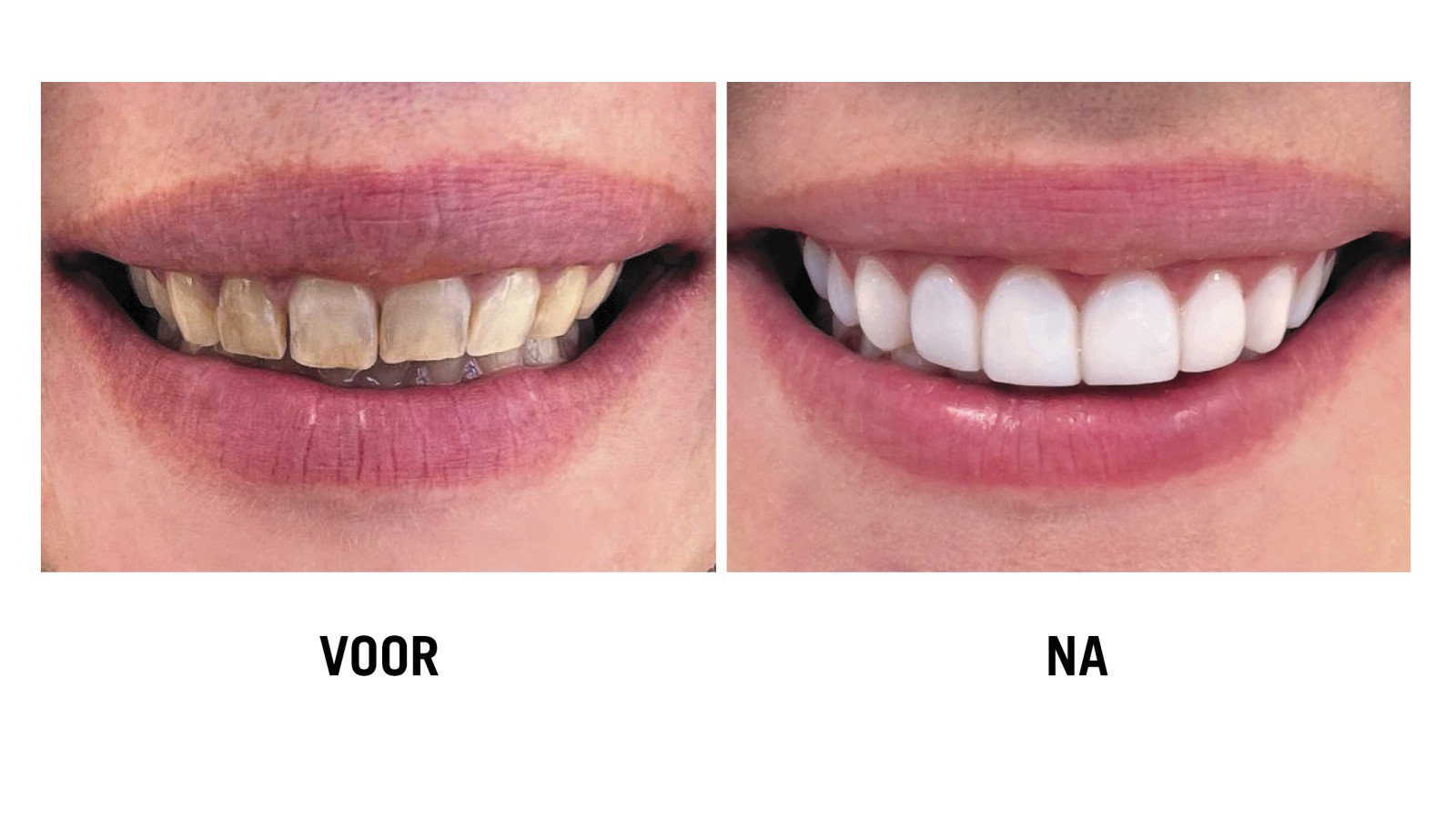Dental&Co