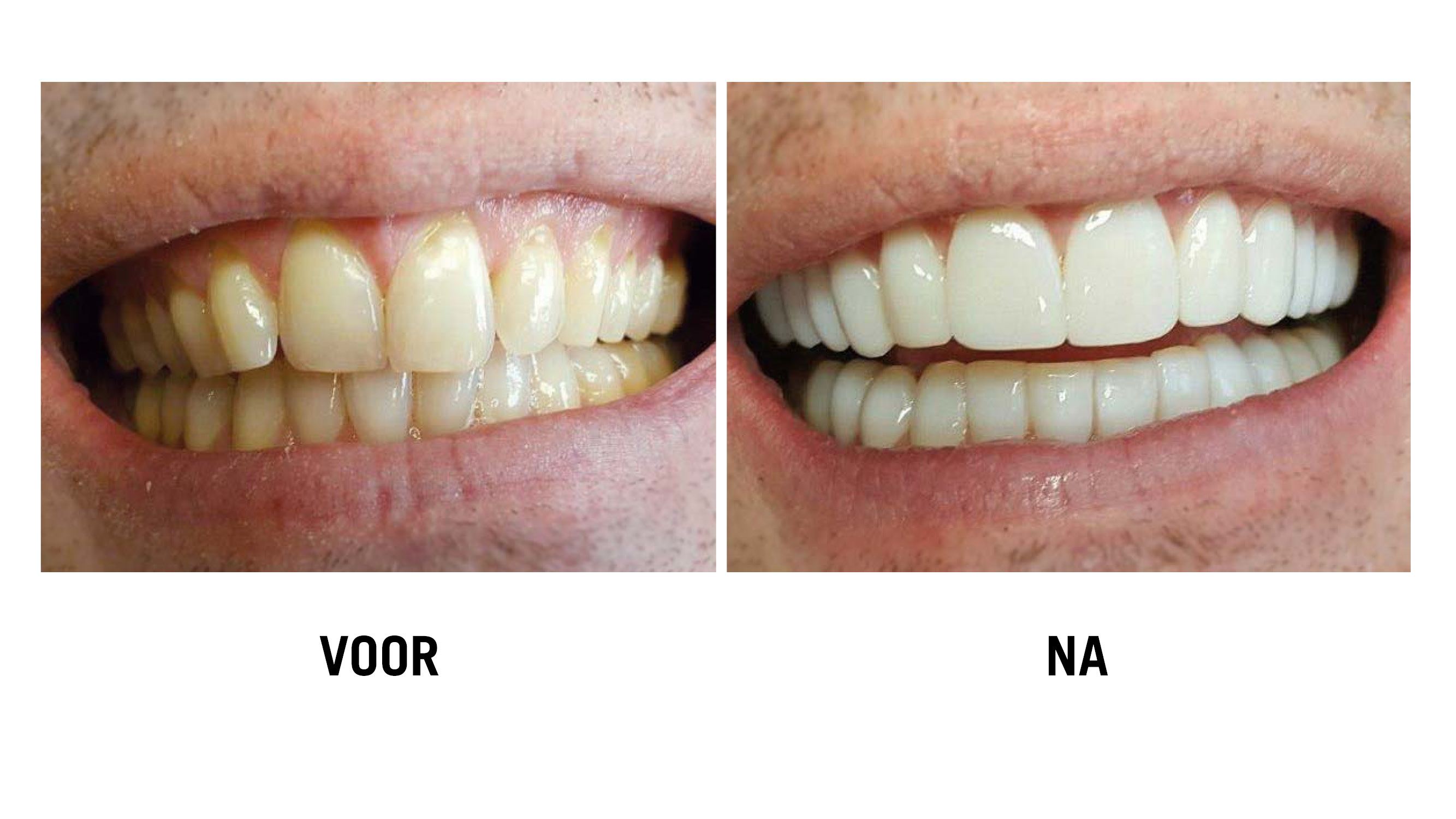 RestyleYourSmile