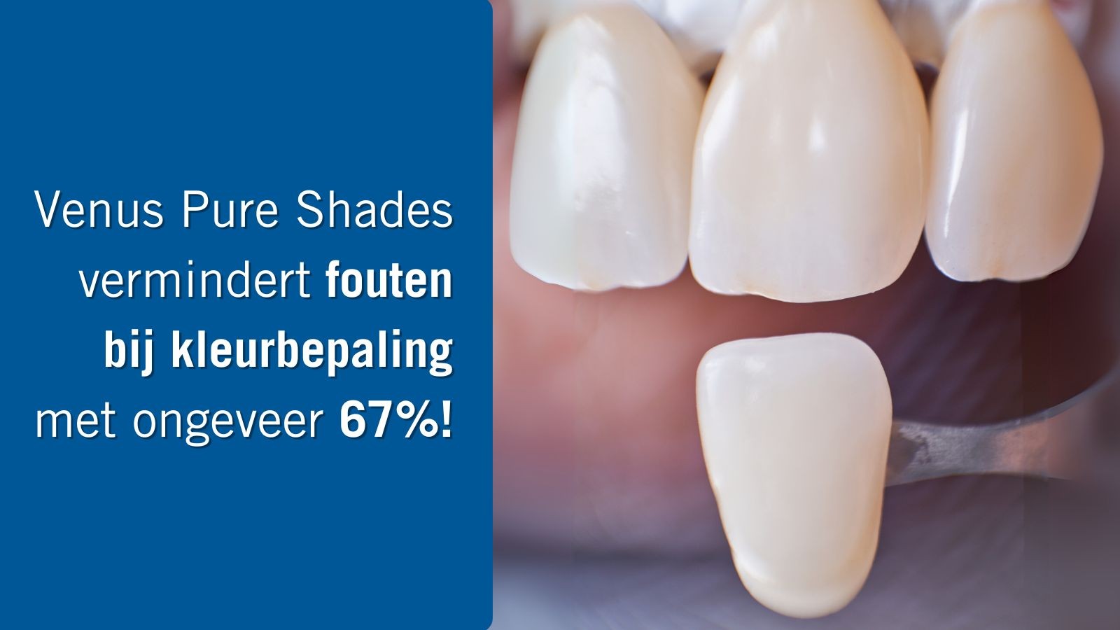 Studie bevestigt: Vereenvoudigde layering, mooie resultaten