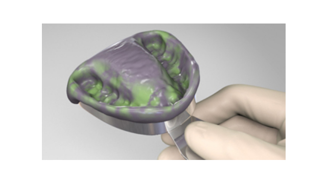 A-Siliconen VPS Precisie Afdrukmaterialen