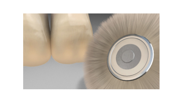 Accessoires Veneering Composieten