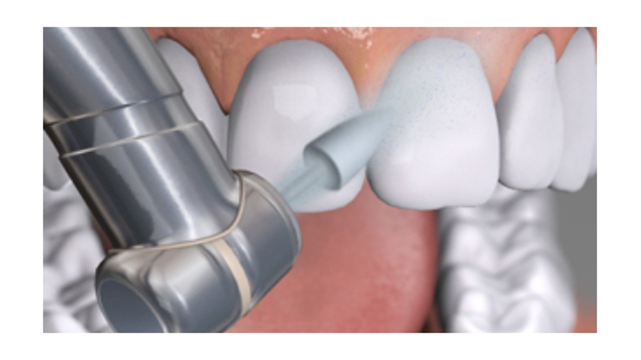 Restauratieve materialen 