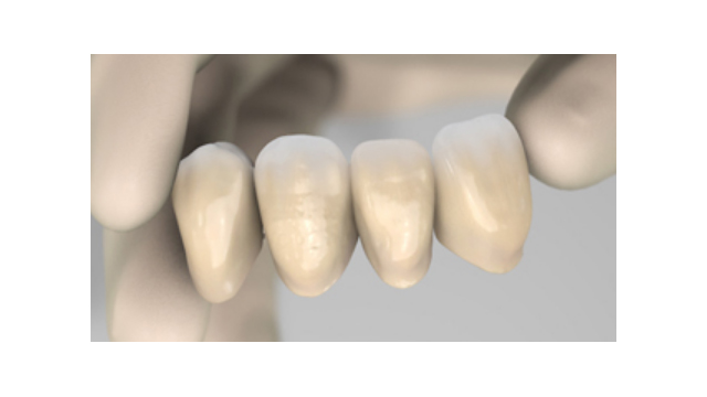 Tijdelijke materialen