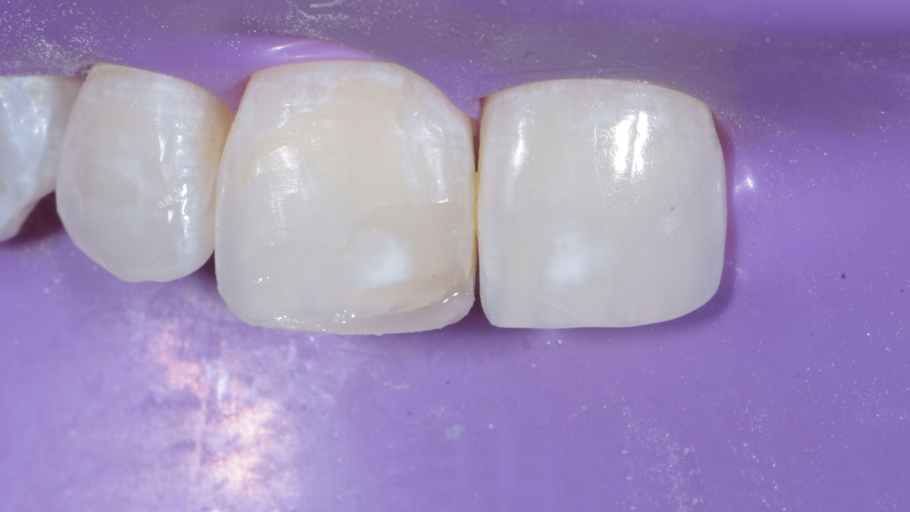 Eerste laag met Venus Pearl LIGHT