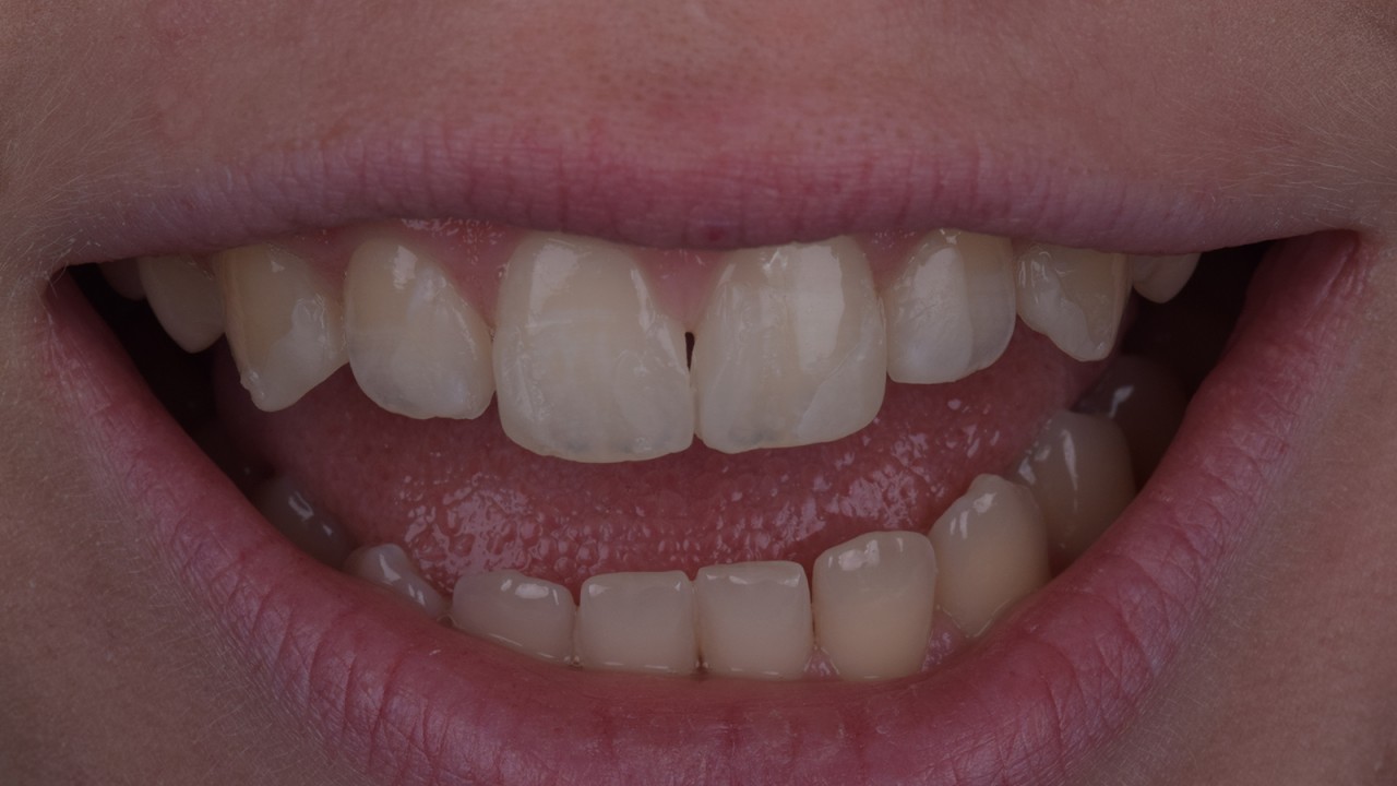 Grove directe mock-up om de verhoudingen te visualiseren.